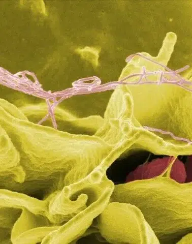 ABD sağlık yetkilileri açıkladı: Jalapeño biberlerinde Salmonella tehdidi!